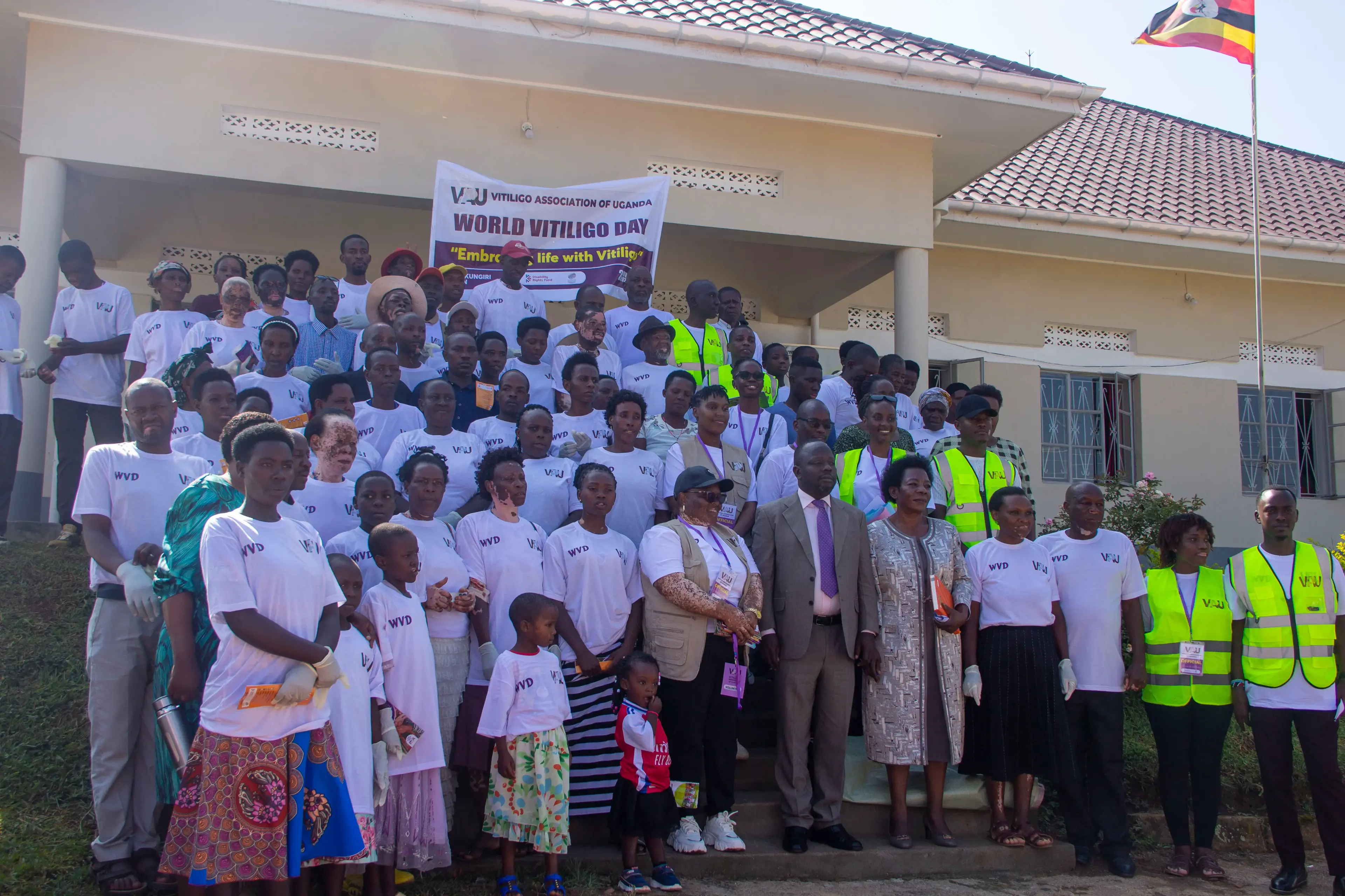 World Vitiligo Month 2025: Innovation for Every Skin