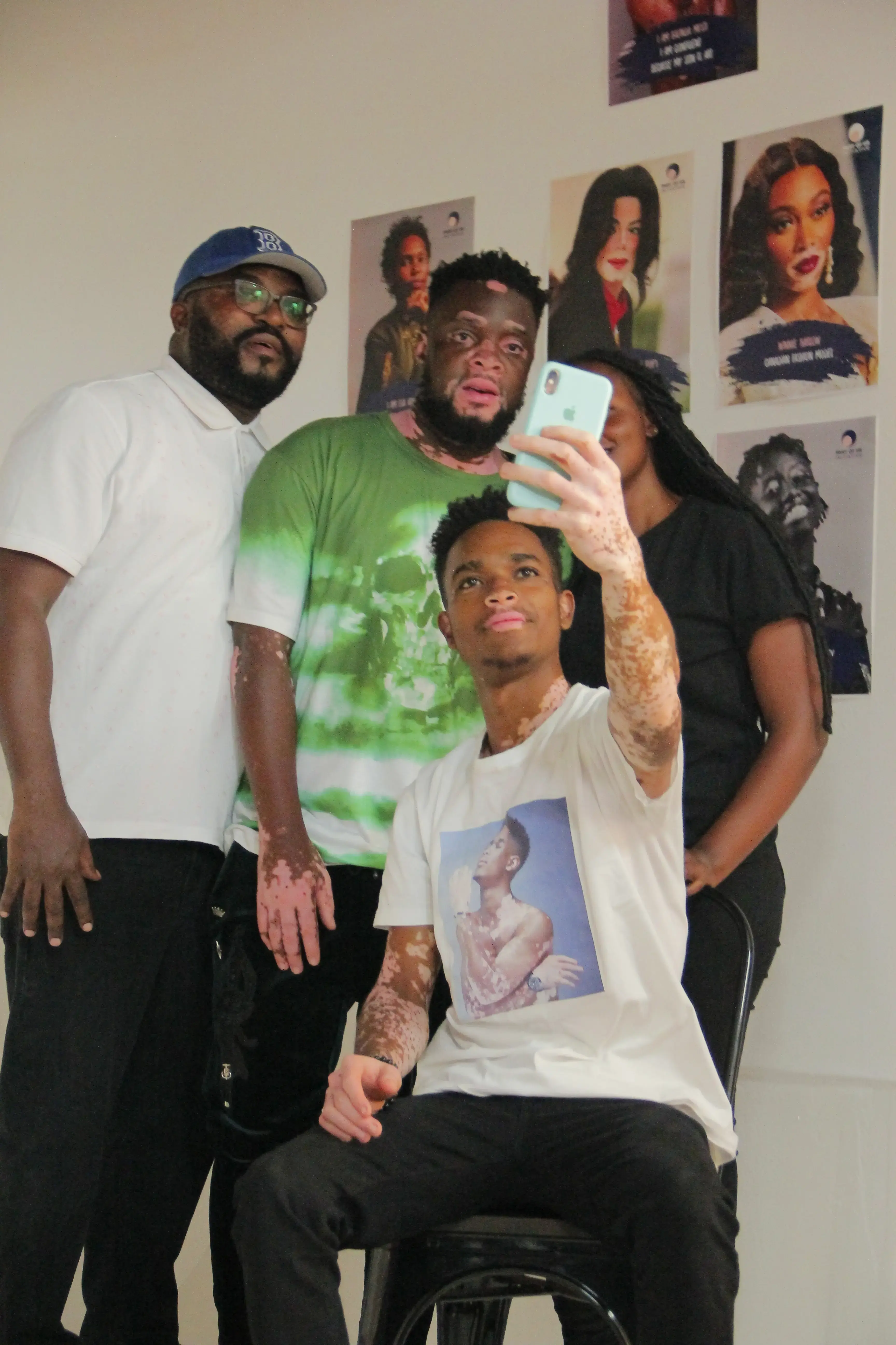 World Vitiligo Day 2022: Digital Takeover